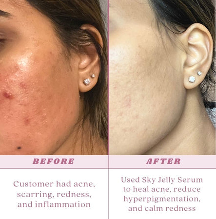 Himalayan Halo Brightening Oil
