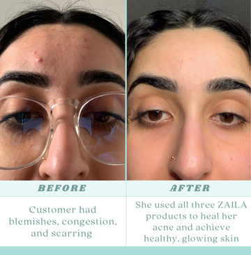 Silk Smoothie Moisturizer – ZAILA SKIN